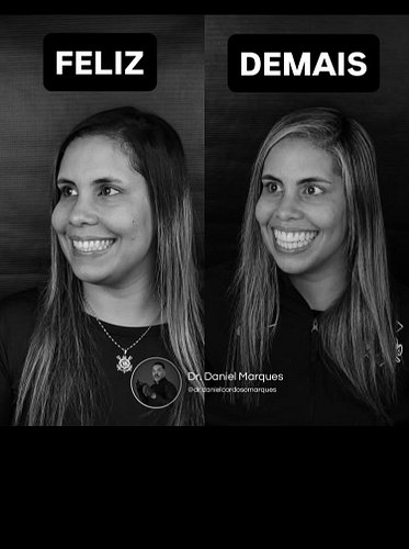 Expor os dentes é uma forma de aproximar ou afastar. Por isso muita gente quer ter sorriso de desenho animado. Quando é demai...