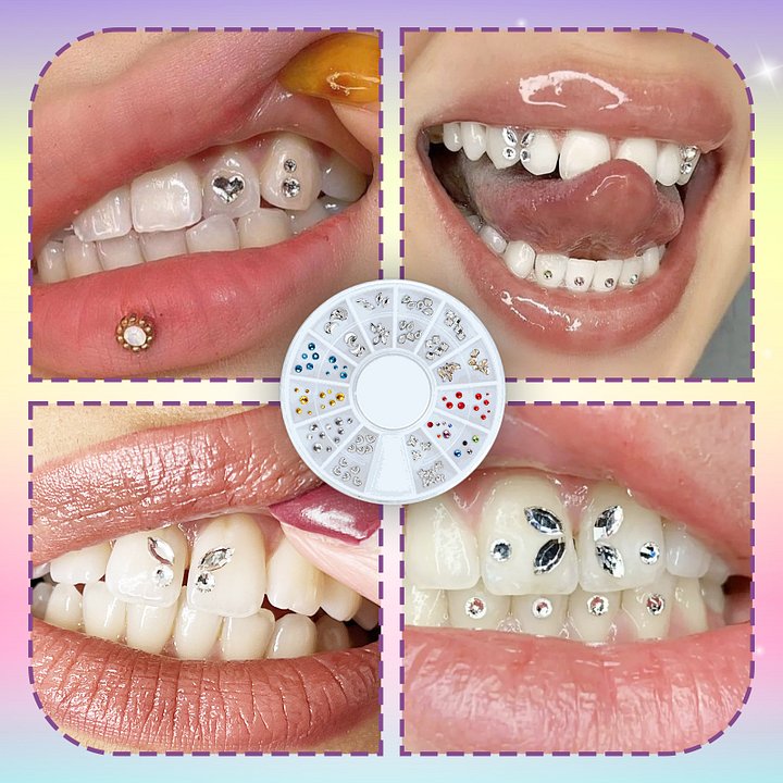 Diamond Sparkle Tooth Gem Kit product image (2)