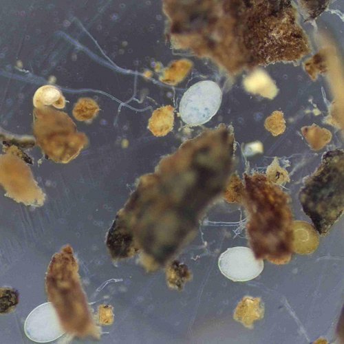 What are healthy soils for native plants? In order to evaluate soil health, we need to see what's living in the soil. 

After...