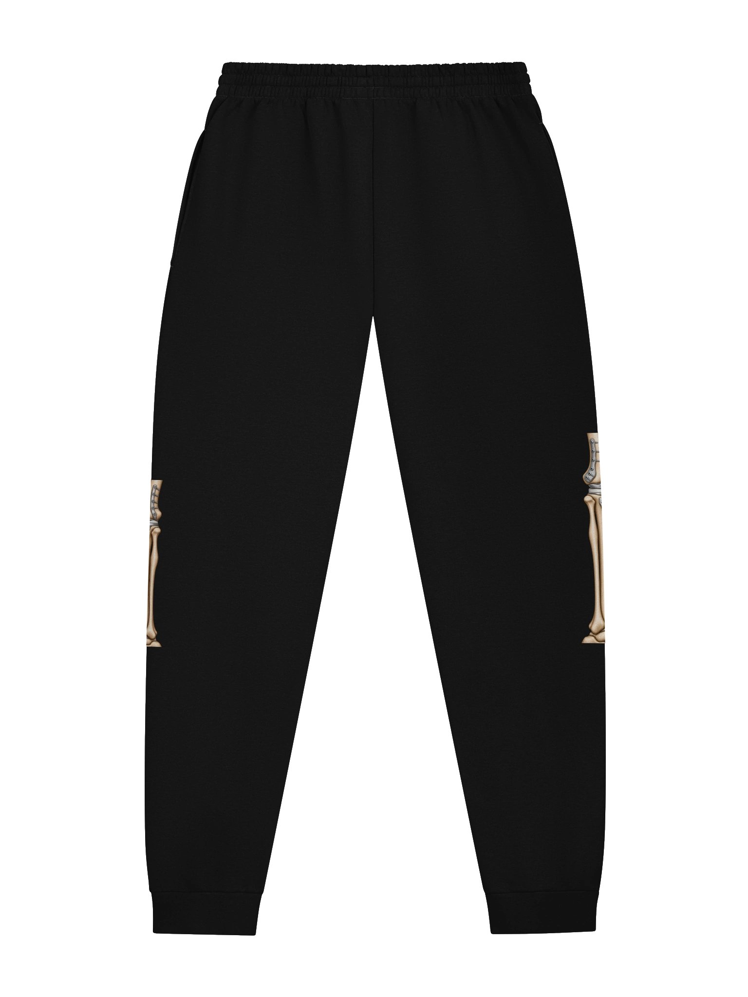 Bilateral Knee Surgery Joggers — Aftermarket Parts Recovery Design | Rebuild Shop product image (3)