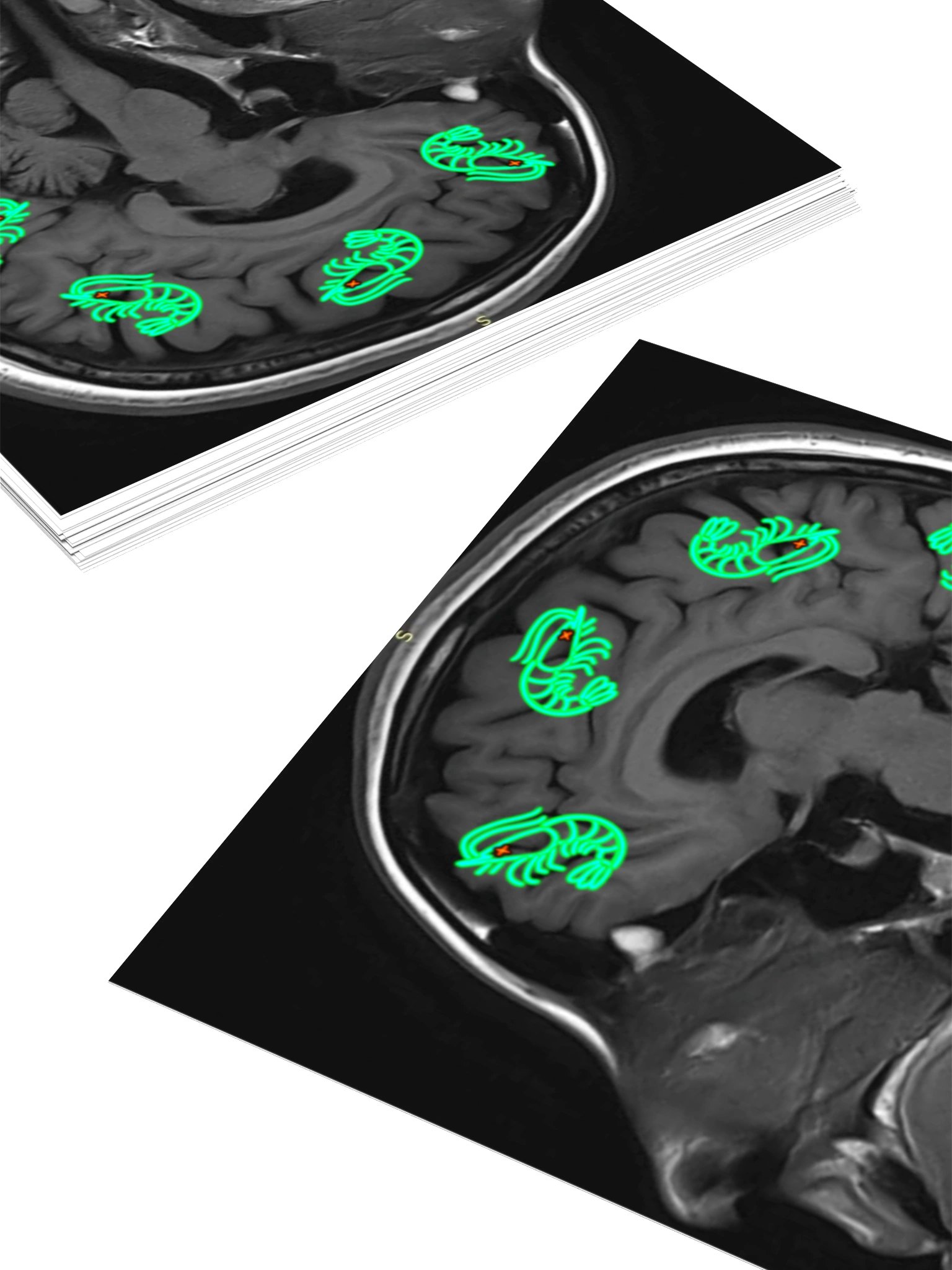 RADIOACTIVE SHRIMP ON THE MIND product image (4)
