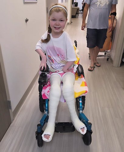 Yesterday was round 1 of Ana's serial casting. She was casted into flexion. There's a short video on the other platform if yo...