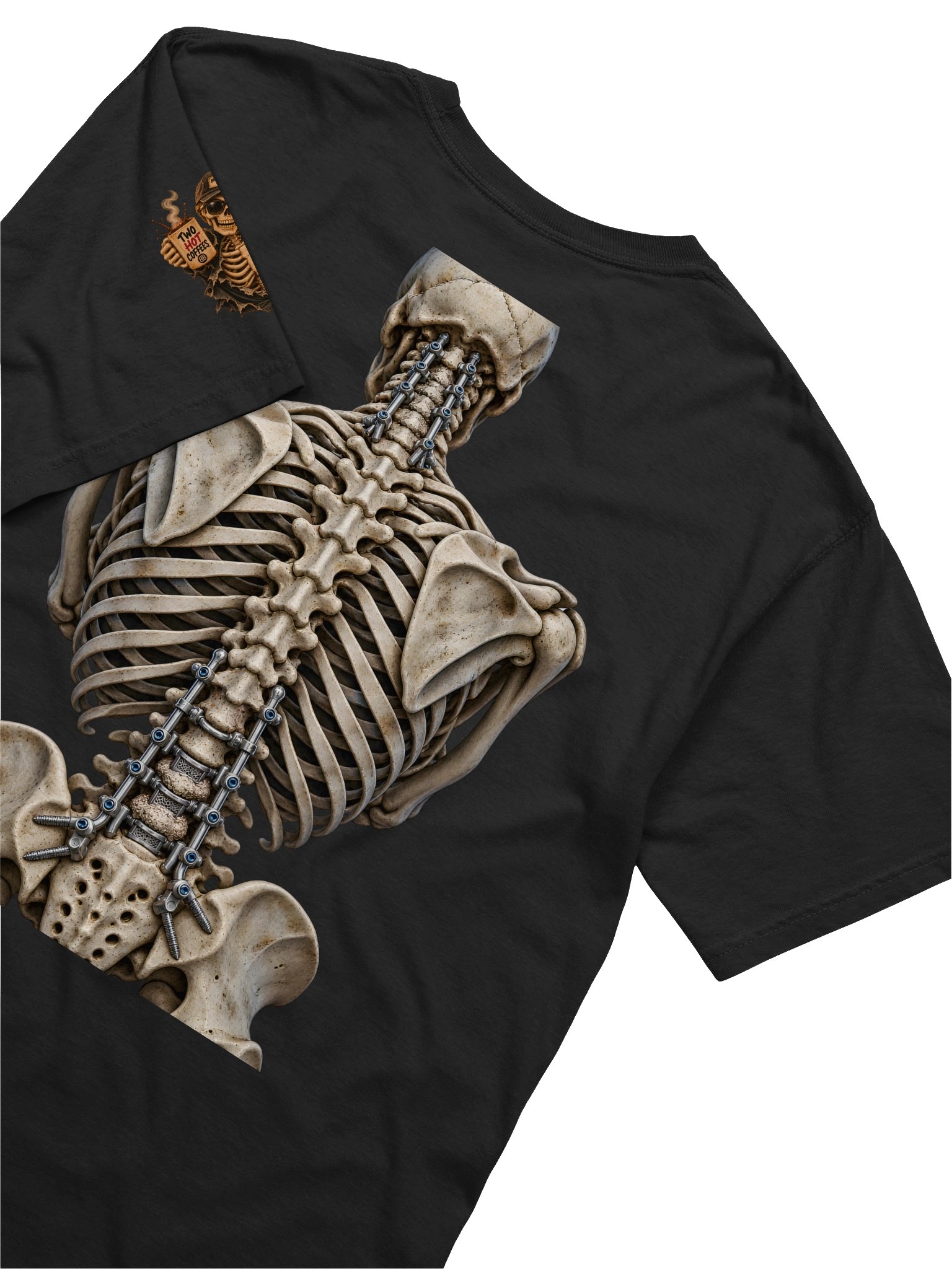 Spinal Fusion Surgery Shirt — Aftermarket Parts Surgical Spine Tee | Rebuild Shop product image (11)