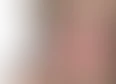 Emotes's tag thumbnail
