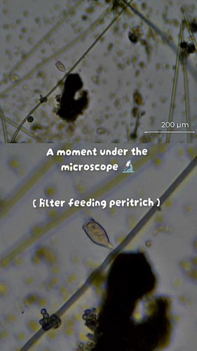 Exploring the hidden details of the microscopic world - let's see what creatures can dwell within a droplet of water.
🔬 Under...