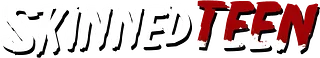 skinnedteen