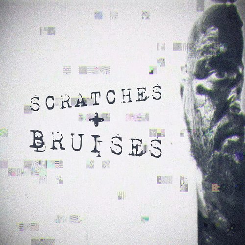 SCRATCHES + BRUISES | 12.29.2025
