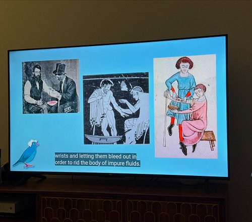 When you get home from a night out, and your teen is watching a YouTube video about bloodletting. #blessed