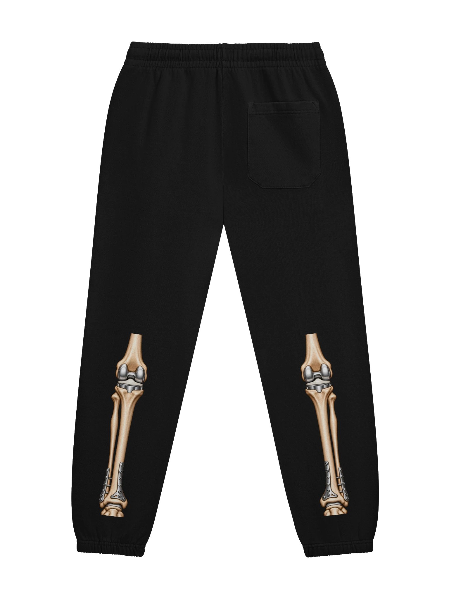Double Knee Replacement Joggers — Aftermarket Parts Surgery Design | Rebuild Shop product image (3)