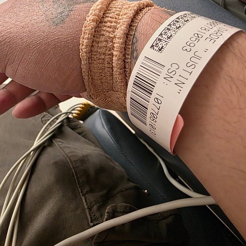 So... It's congestive heart failure. Fun...
