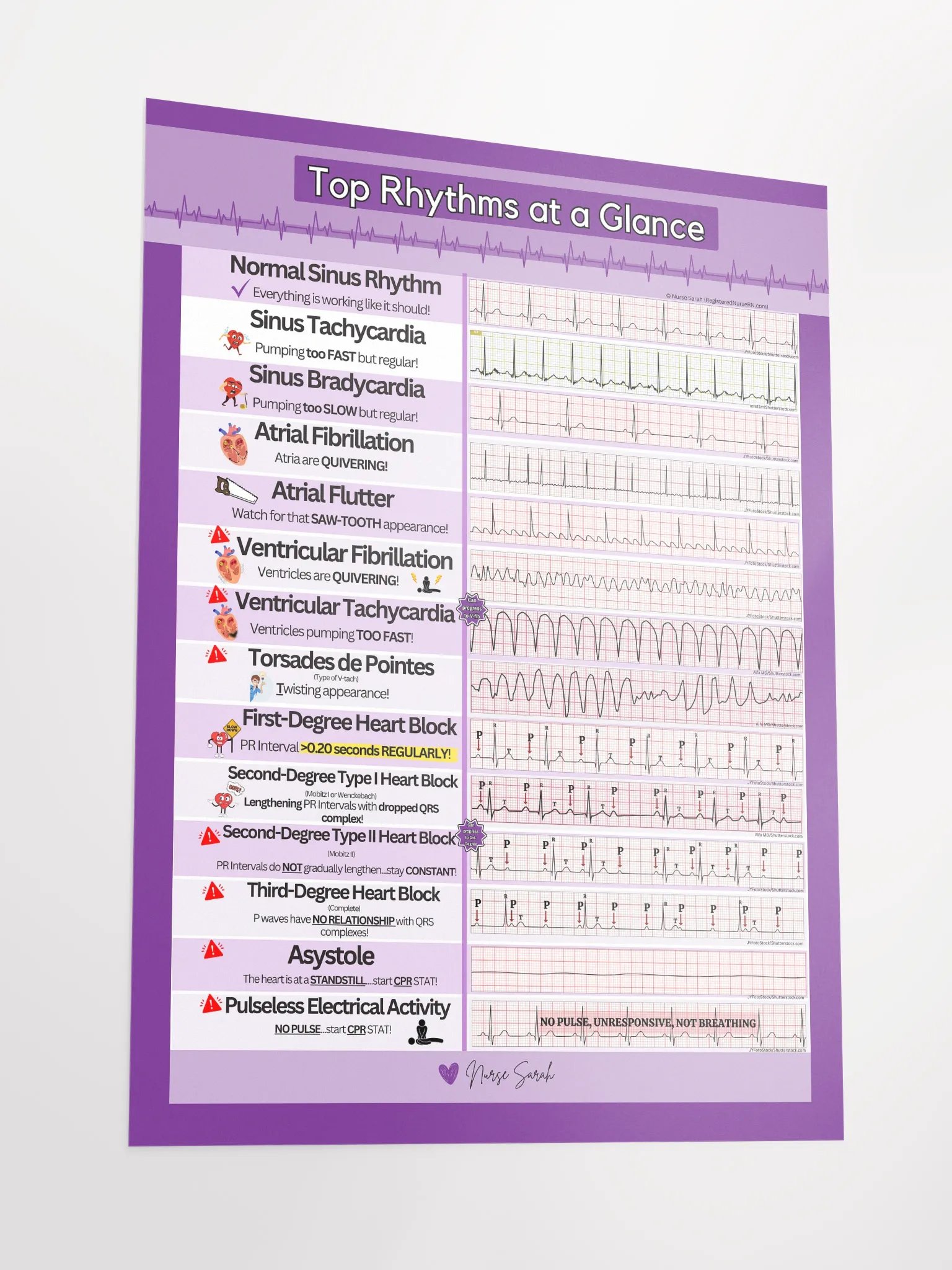 ECG/EKG Rhythms at a Glance Wall Poster by Nurse Sarah product image (3)