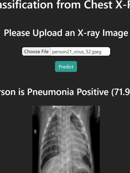 Pneumonia Detection from Chest X-Ray with Flask App Deep Learning Project product image (10)