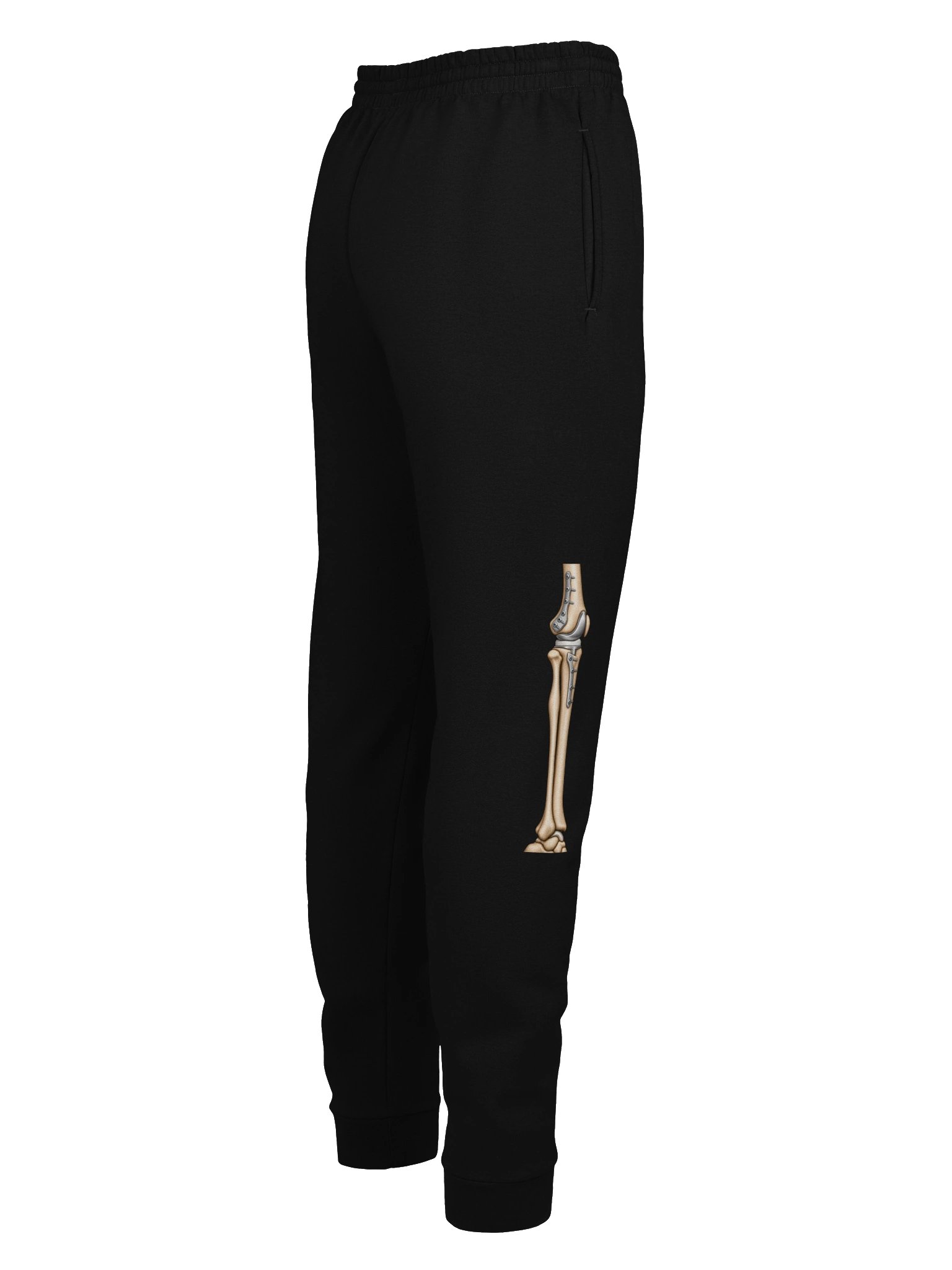 Bilateral Knee Surgery Joggers — Aftermarket Parts Recovery Design | Rebuild Shop product image (5)