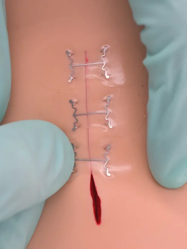 Wound Closure Devices (Zip-Stitches, Micromend, Clozex) product image (4)