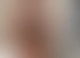 Biceps's tag thumbnail