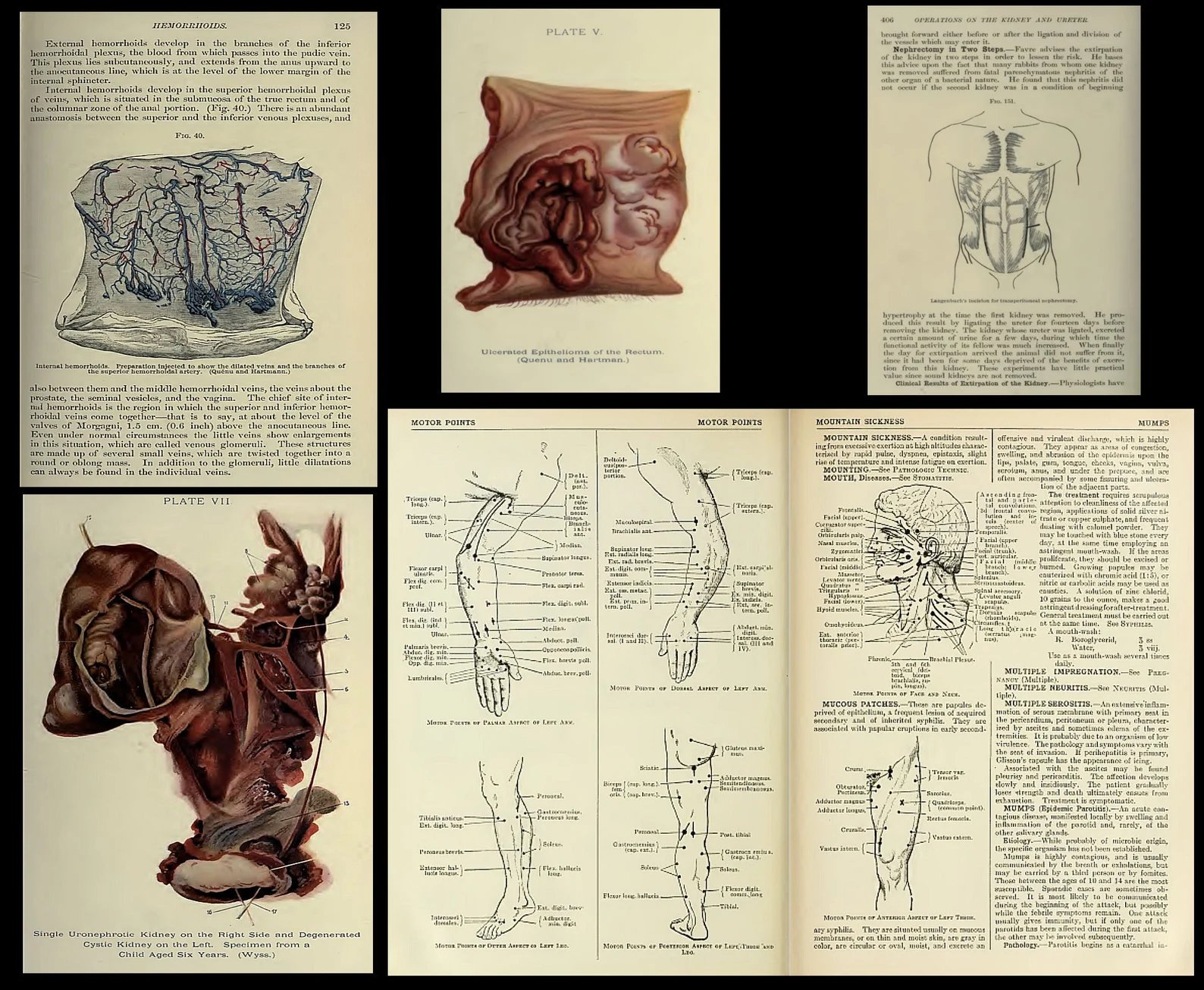 320 Rare Surgery Books product image (6)