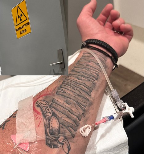 Fuck Cancer. Thank you all for your help with this first round. If it weren’t for you I couldn’t have done this and now that ...