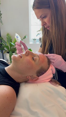 Combining facial microneedling with full-body acupuncture pairs localized collagen stimulation—which can improve skin texture...