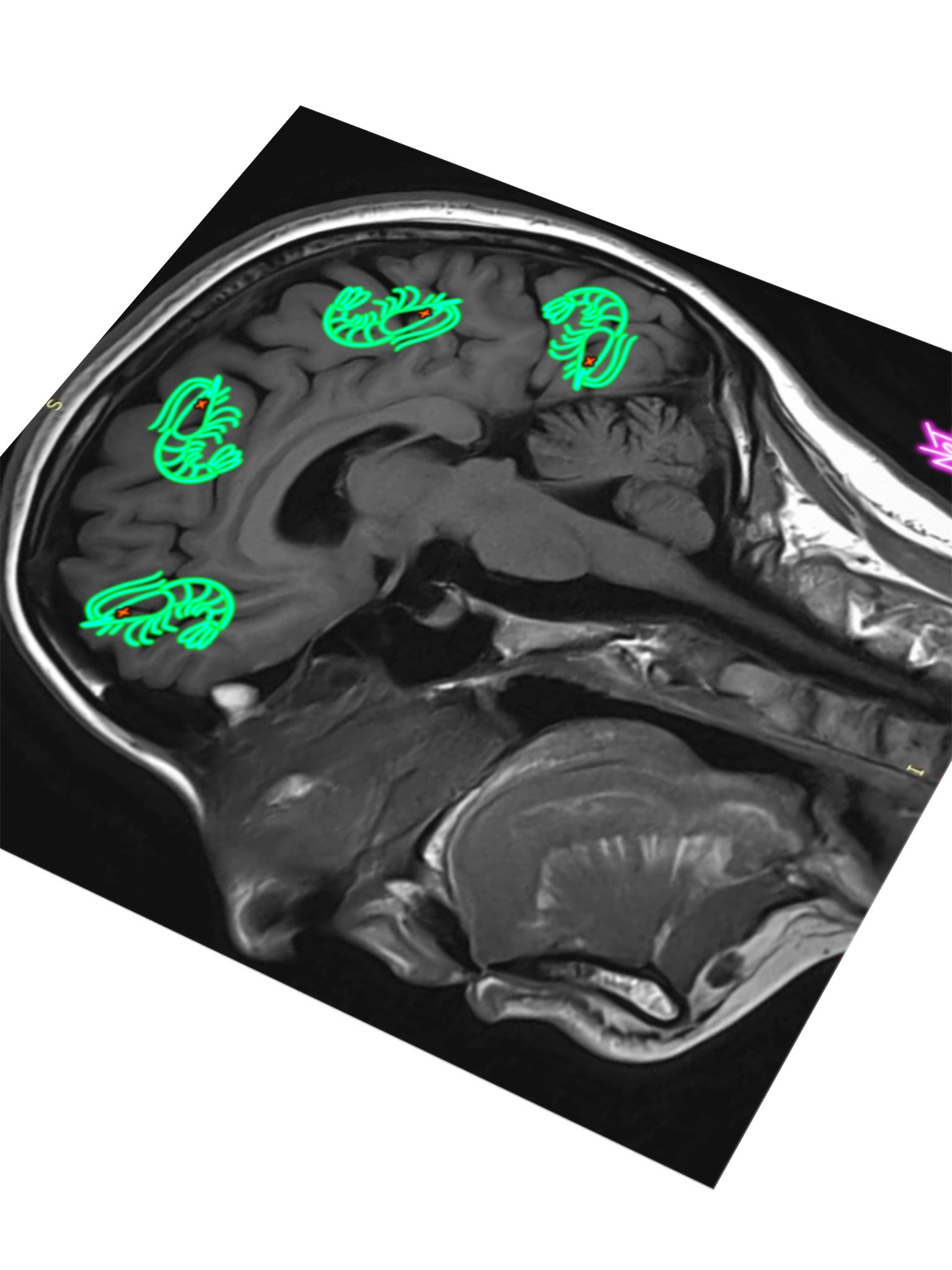 RADIOACTIVE SHRIMP ON THE MIND product image (3)