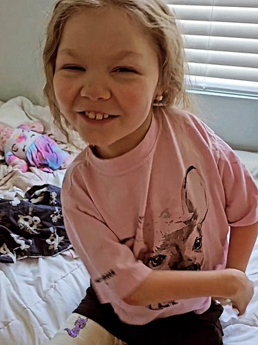 A video has been posted! Head over to watch it - it's a day in the life of Arthrogryposis serial casting. Content from 2024 b...