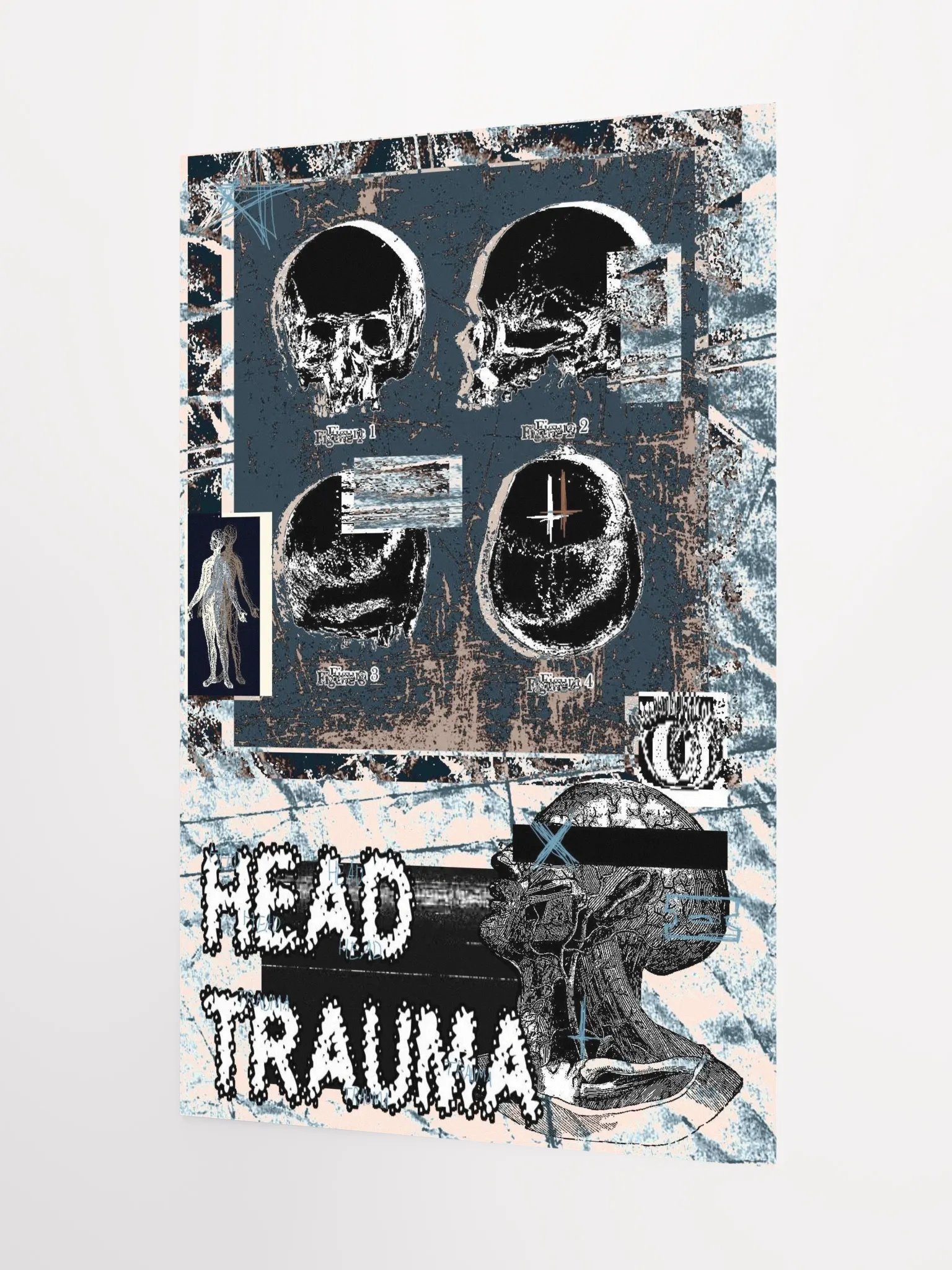 head trauma print product image (3)