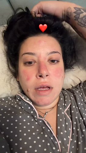 A little update ❤️ and a step in the direction to be more transparent love you all ❤️ #autoimmune #flareup #chronic