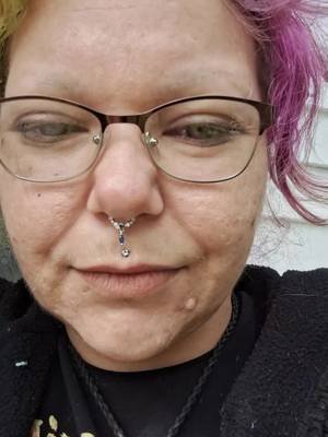 Ignore my puffy face, it's been like that for a few days. my body has felt very uncomfortable for many days now. 