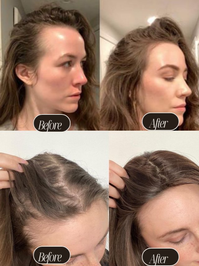 Get Fuller, Healthier Hair in Just 60 Days product image (2)