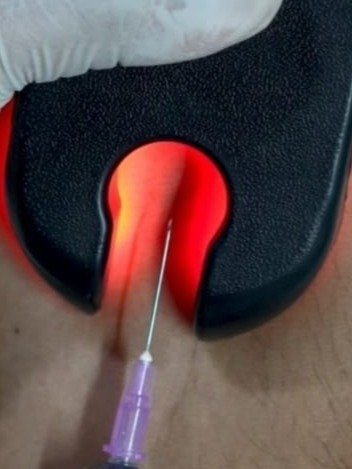 Vein Finder product image (1)