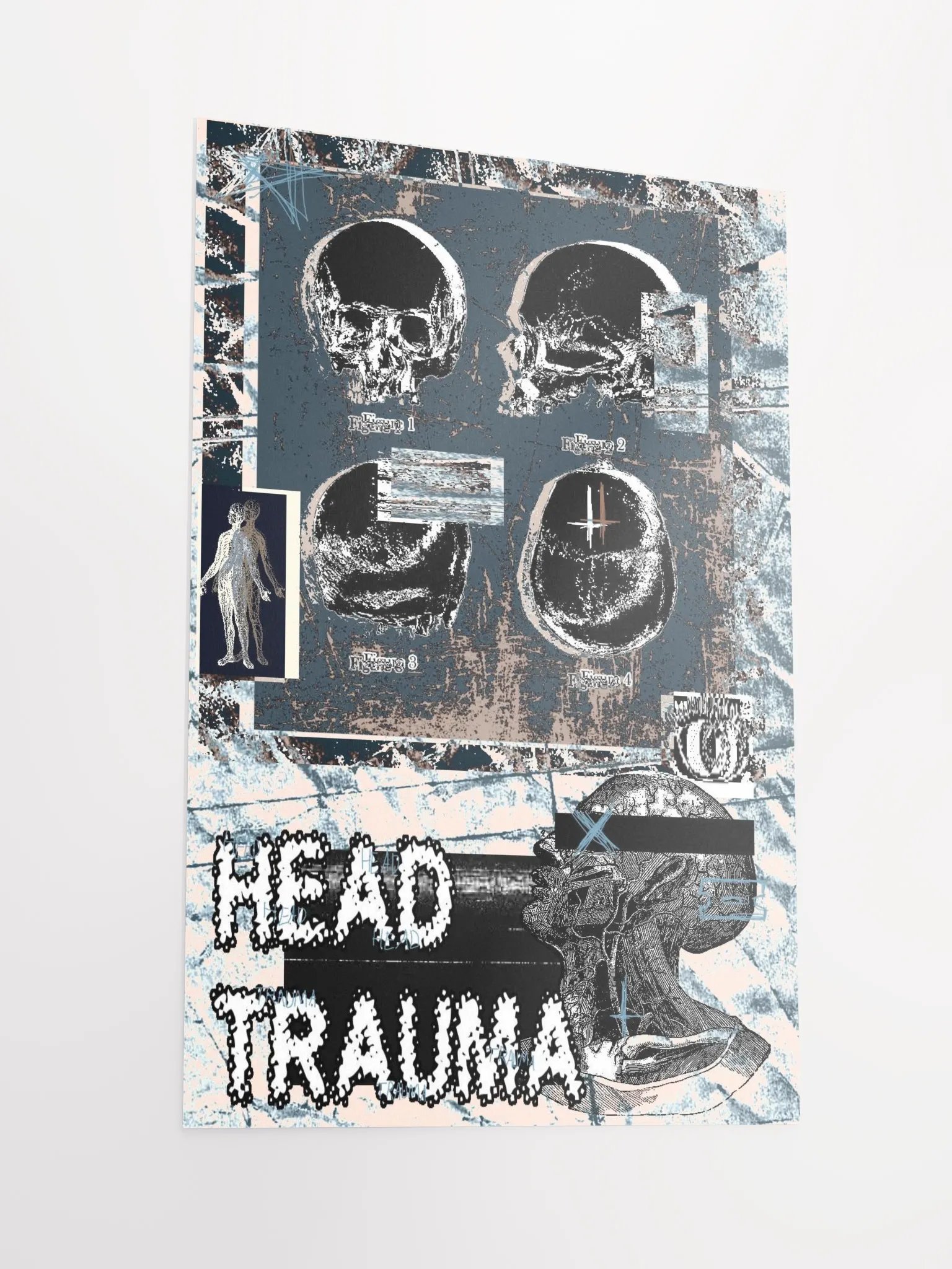 head trauma print product image (2)