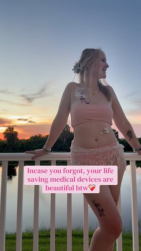 Your medical devices are beautiful babes, don’t you forget it! 💖 Save or share for anyone who needs this important reminder 🫶...