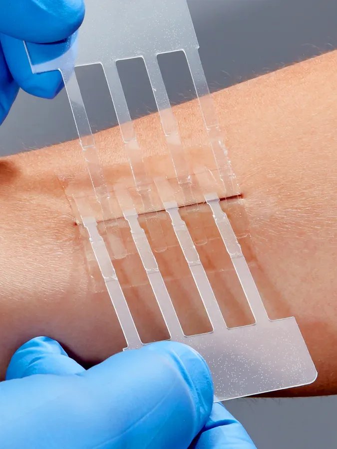 Wound Closure Devices (Zip-Stitches, Micromend, Clozex) product image (11)