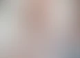 Overactive Pelvic Floor's tag thumbnail