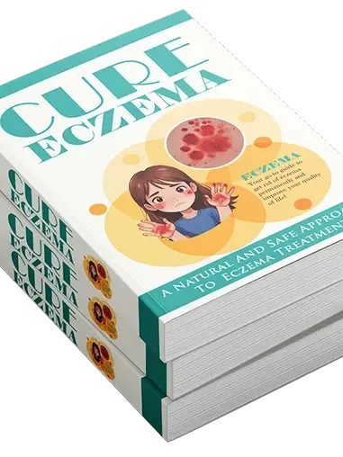 The Eczema Relief Guide — Managing Triggers, Itching & Flare-Ups product image (3)