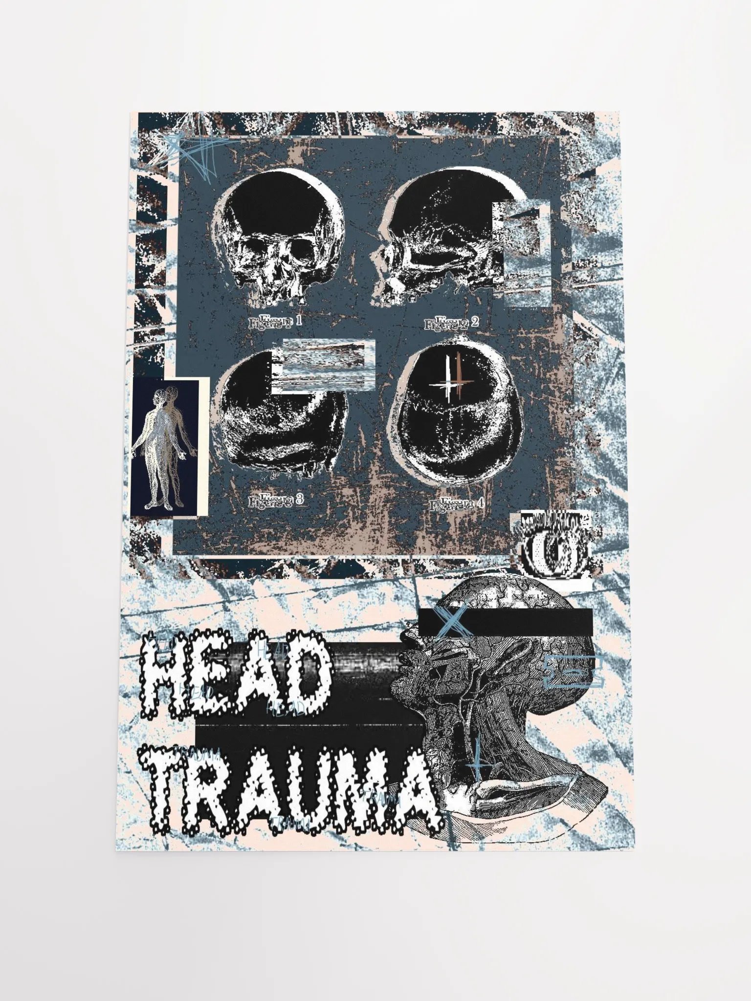 head trauma print product image (1)