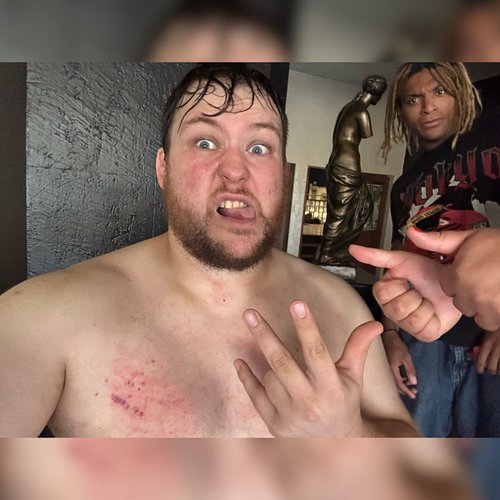 After Chase and I chopped the crap out of each other. And hanging with the boiz.