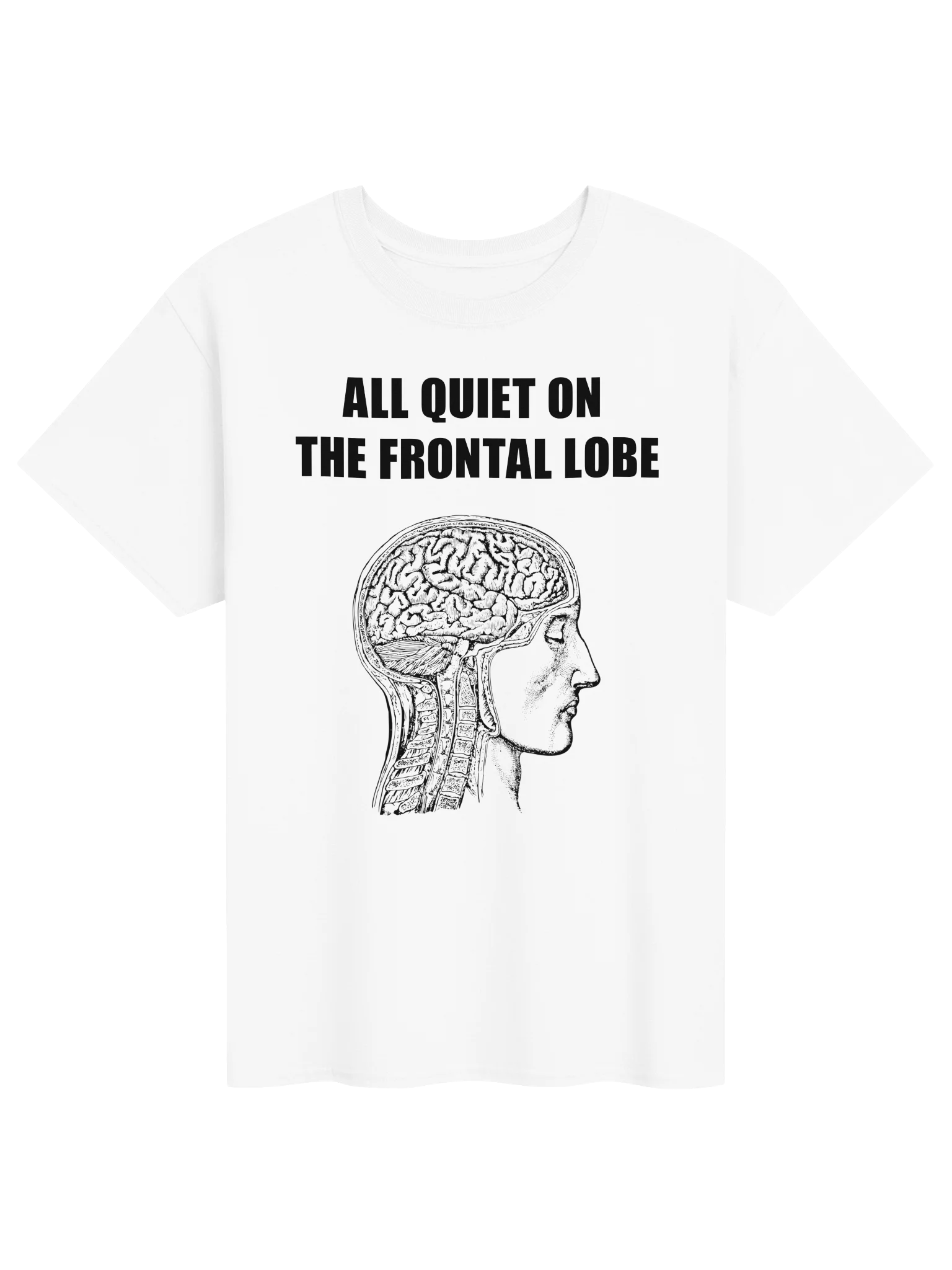 ALL QUIET ON THE FRONTAL LOBE product image (1)