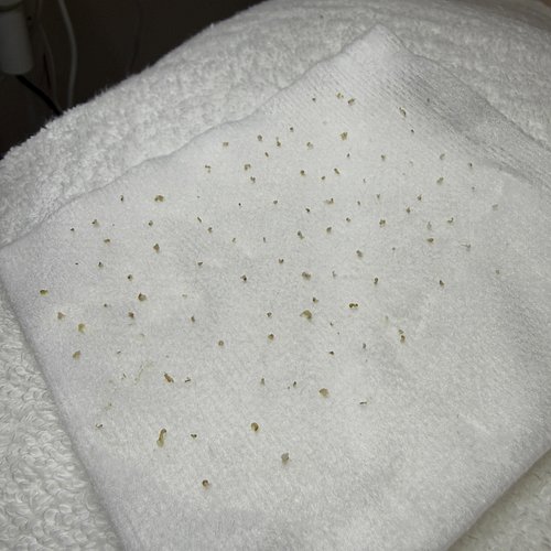 Every estheticians dream 😍 extractions are so satisfying, they not only clear congestion but also help reduce breakouts, and ...