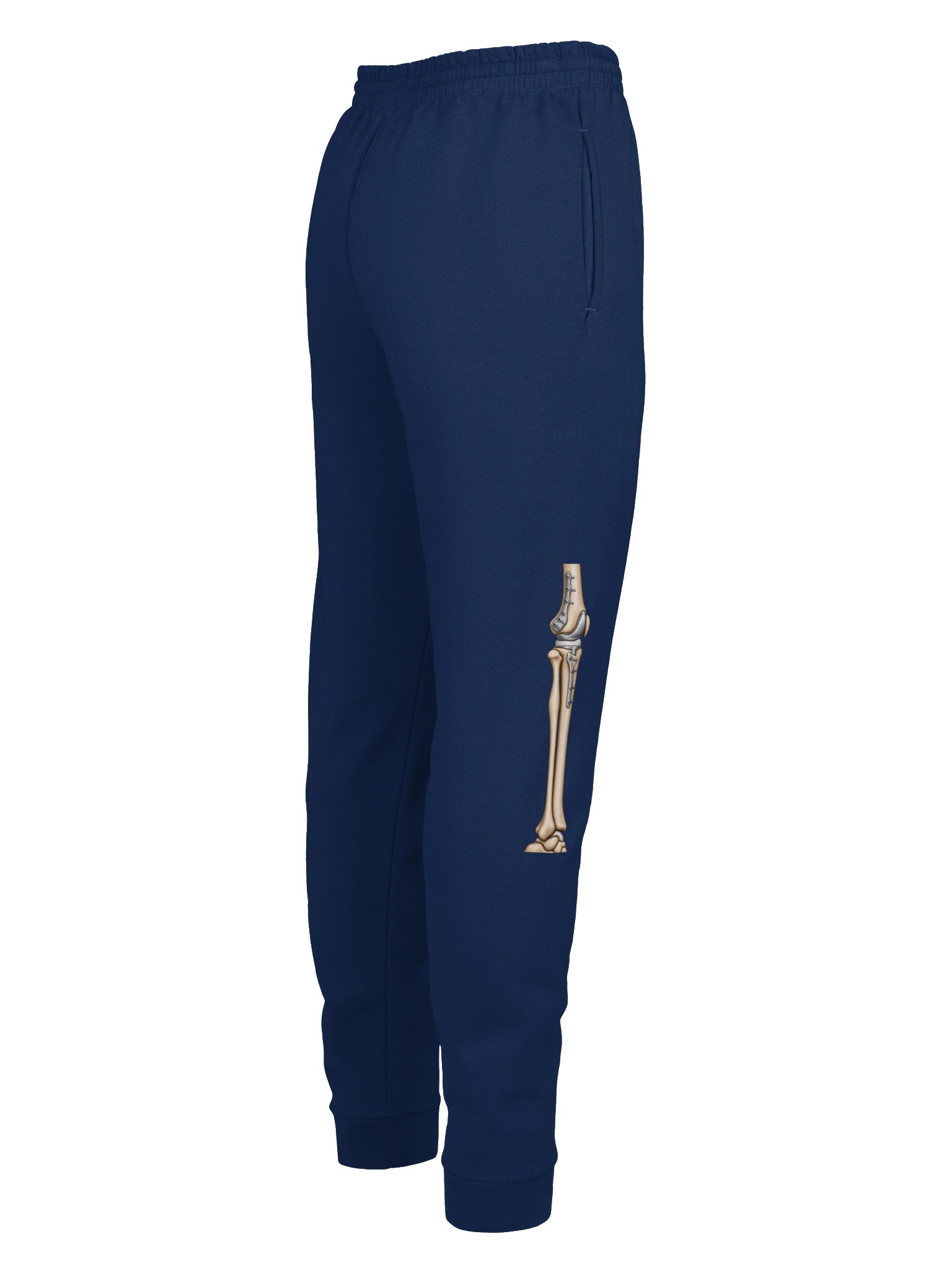 Right Knee Surgery Sweatpants — Aftermarket Parts Recovery Design | Rebuild Shop product image (5)