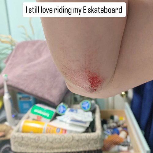I fell down