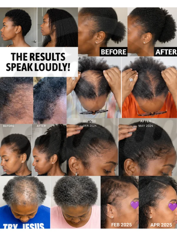 Thriving Tresses: A Natural Hair Growth Guide product image (2)