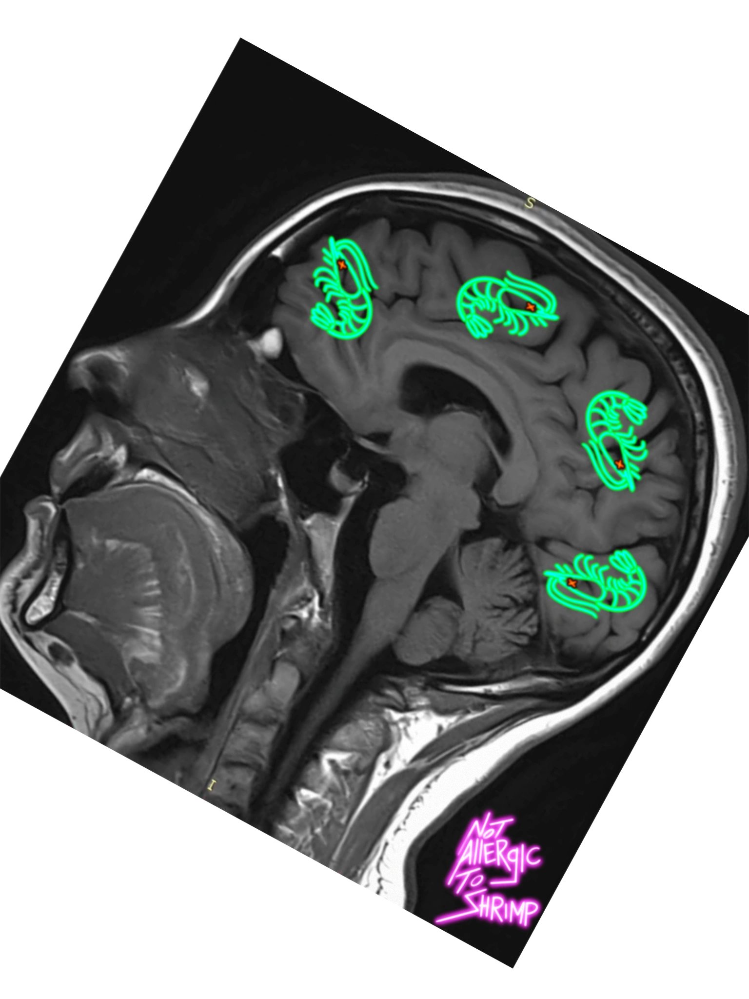 RADIOACTIVE SHRIMP ON THE MIND product image (2)