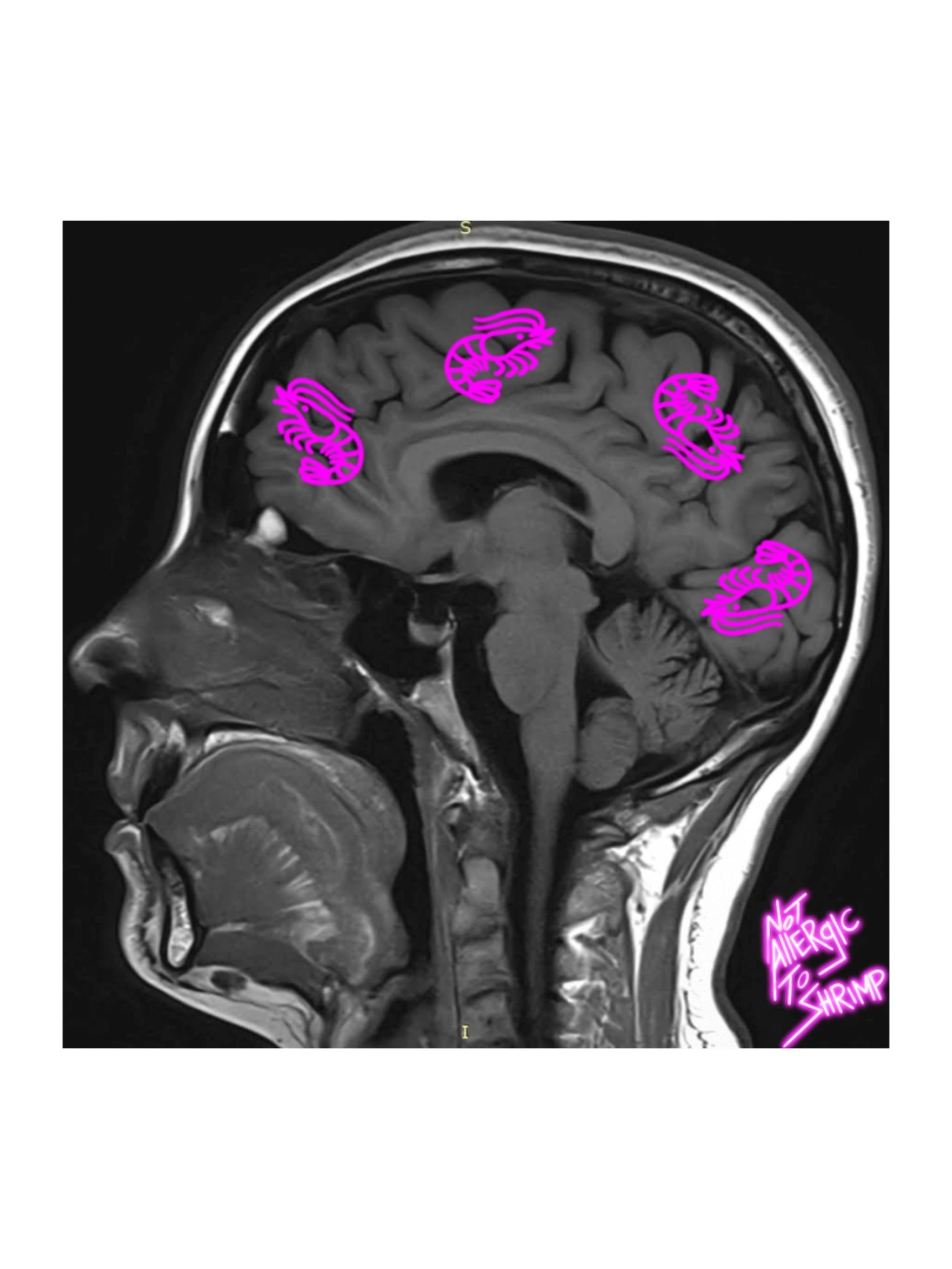SHRIMP ON THE MIND product image (1)