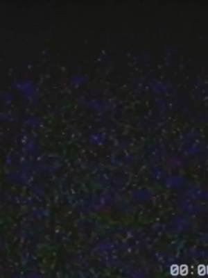 C̶̬̏ͅƠ̵̰͖͑̽U̸̥̘̾͂̃I̶̧͖͈͊̆N̵̥͜͝T̵̝̙͉̅Í̵̧ͅN̶̢͌͜ ̶̘͌͆͑T̵̘͍͖̋͊̉H̷̳̫̊͊Ë̶̻̥̟́͊ ̸̫̱̅̈̆D̵̳̀̌͒A̵̰͗̃͝YS#yoloderr #youtuber #twitchstreamer #tiktokstreamer #streamerreturn