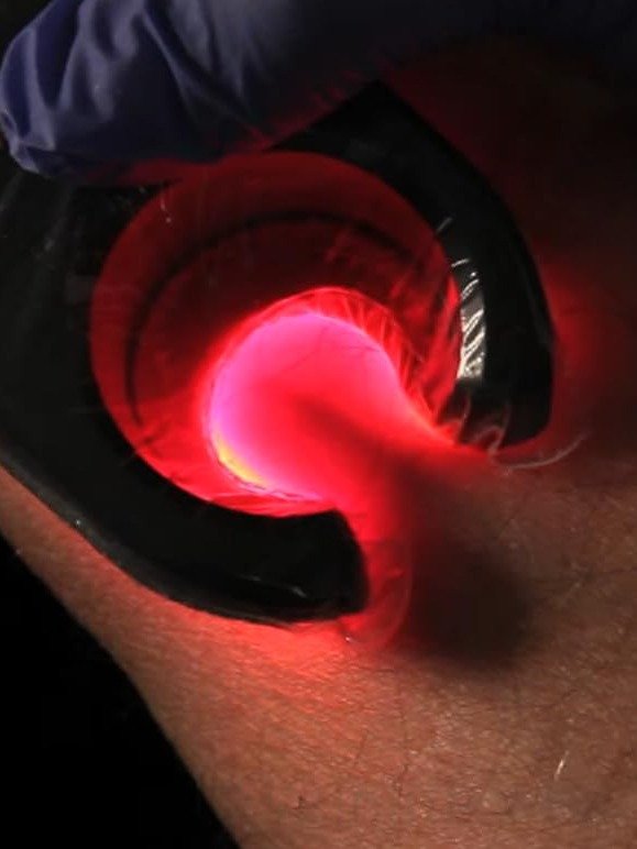 Vein Finder product image (2)