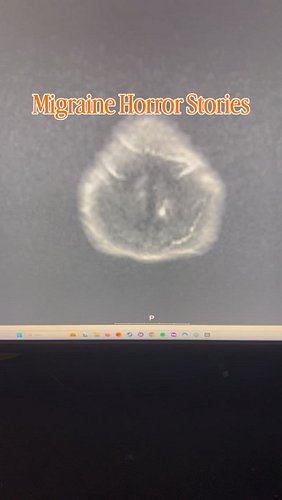 🎃What's your migraine horror story?👇

————
Hi! My name is Isabelle. I’m a physiotherapist and online migraine educator.

Afte...