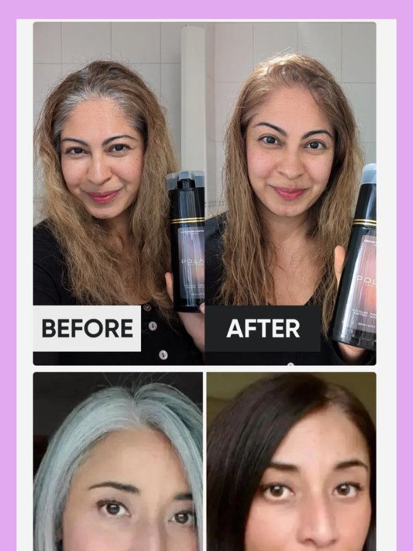 HairRevive Story – Gray Hair Solution Template product image (7)