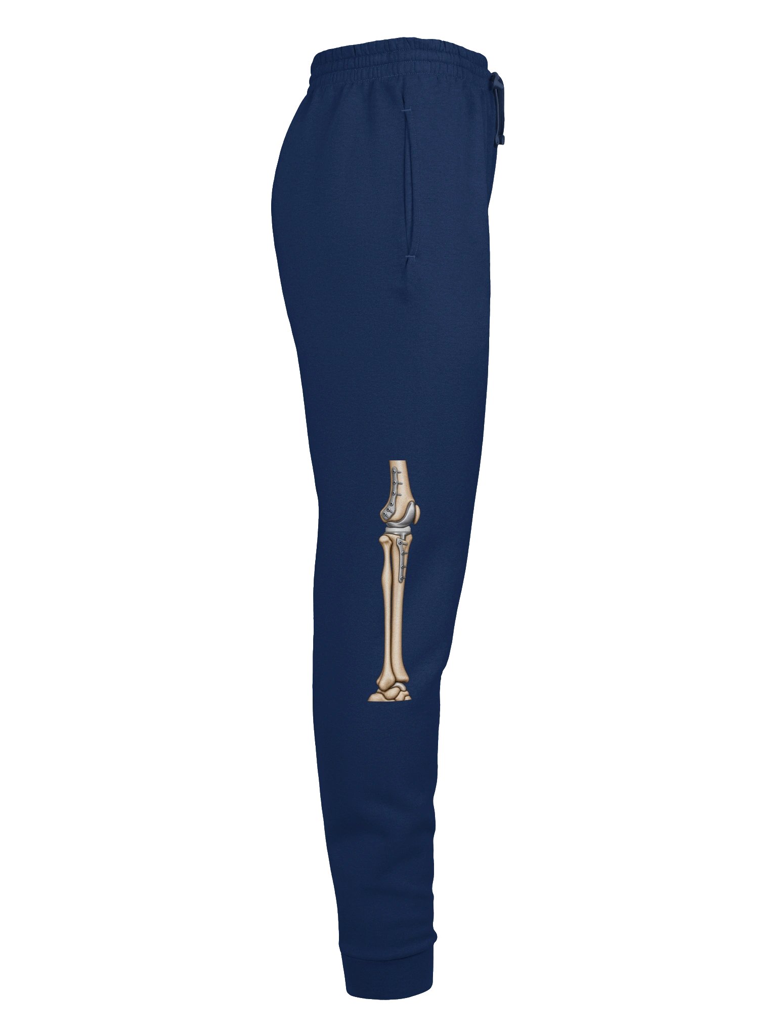 Right Knee Surgery Sweatpants — Aftermarket Parts Recovery Design | Rebuild Shop product image (7)