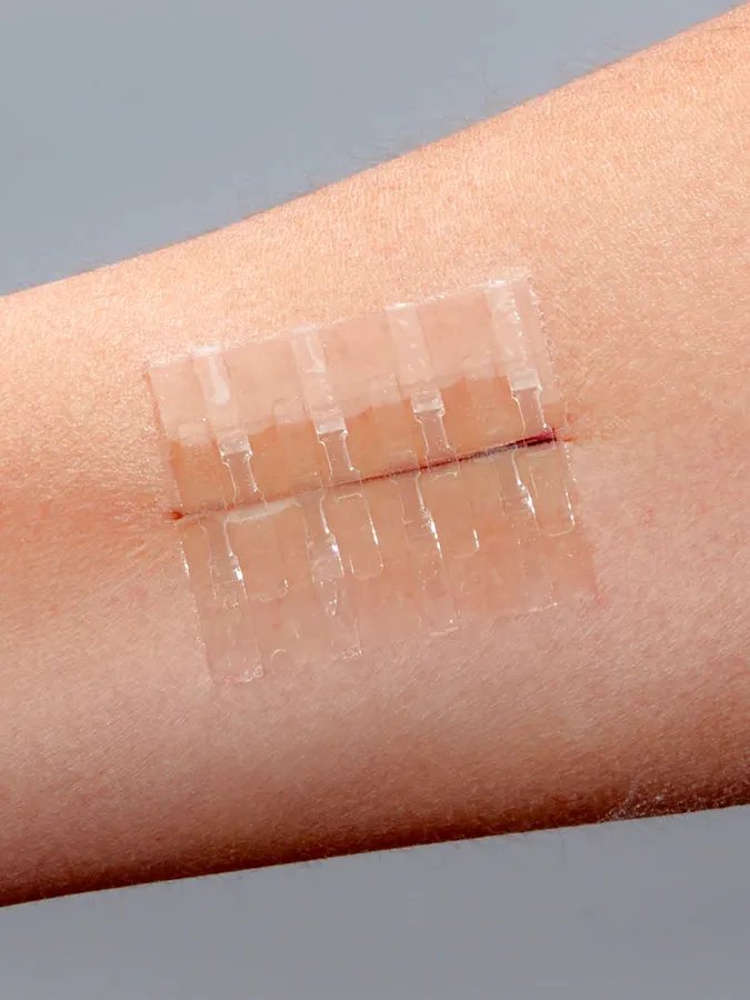 Wound Closure Devices (Zip-Stitches, Micromend, Clozex) product image (12)