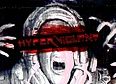 review's tag thumbnail